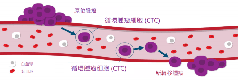 CTC 循環腫瘤細胞