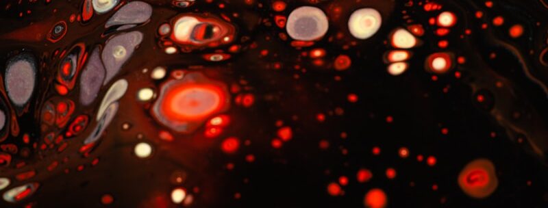 Sd-LDL 超壞膽固醇檢查